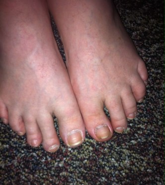 Toes